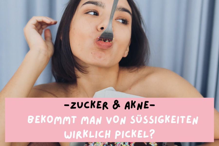 Zucker & Akne – Bekommt man von Süßigkeiten wirklich Pickel?