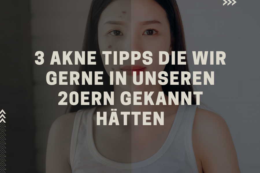 3 Akne Tipps die wir gerne in unseren 20ern gekannt hätten