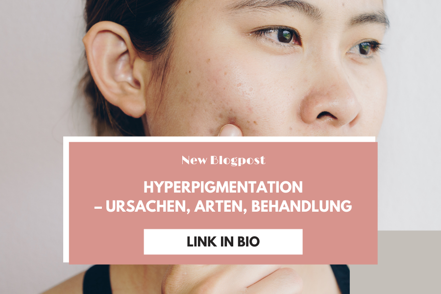 Hyperpigmentation – Ursachen, Arten, Behandlung