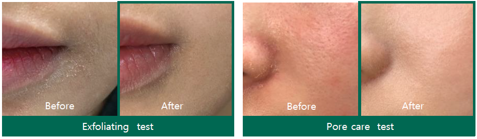 SOMEBYMI AHA-BHA-PHA 30 days Miracle Toner