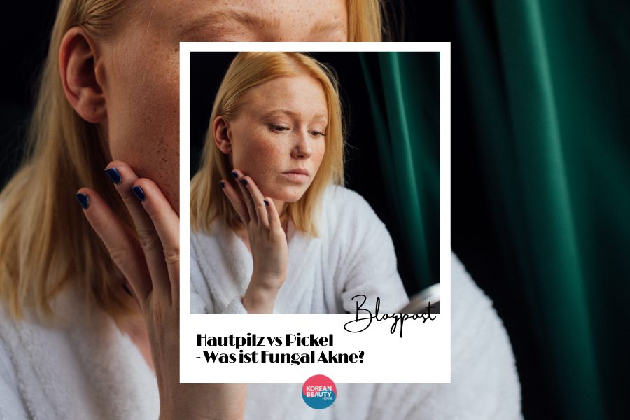 Hautpilz vs Pickel – Was ist Fungal Akne?