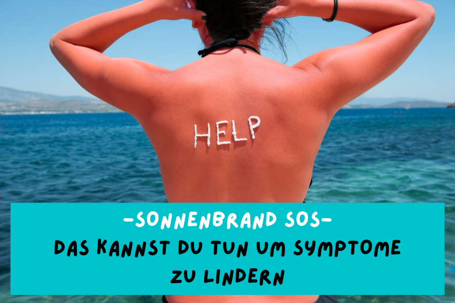 Sonnenbrand SOS