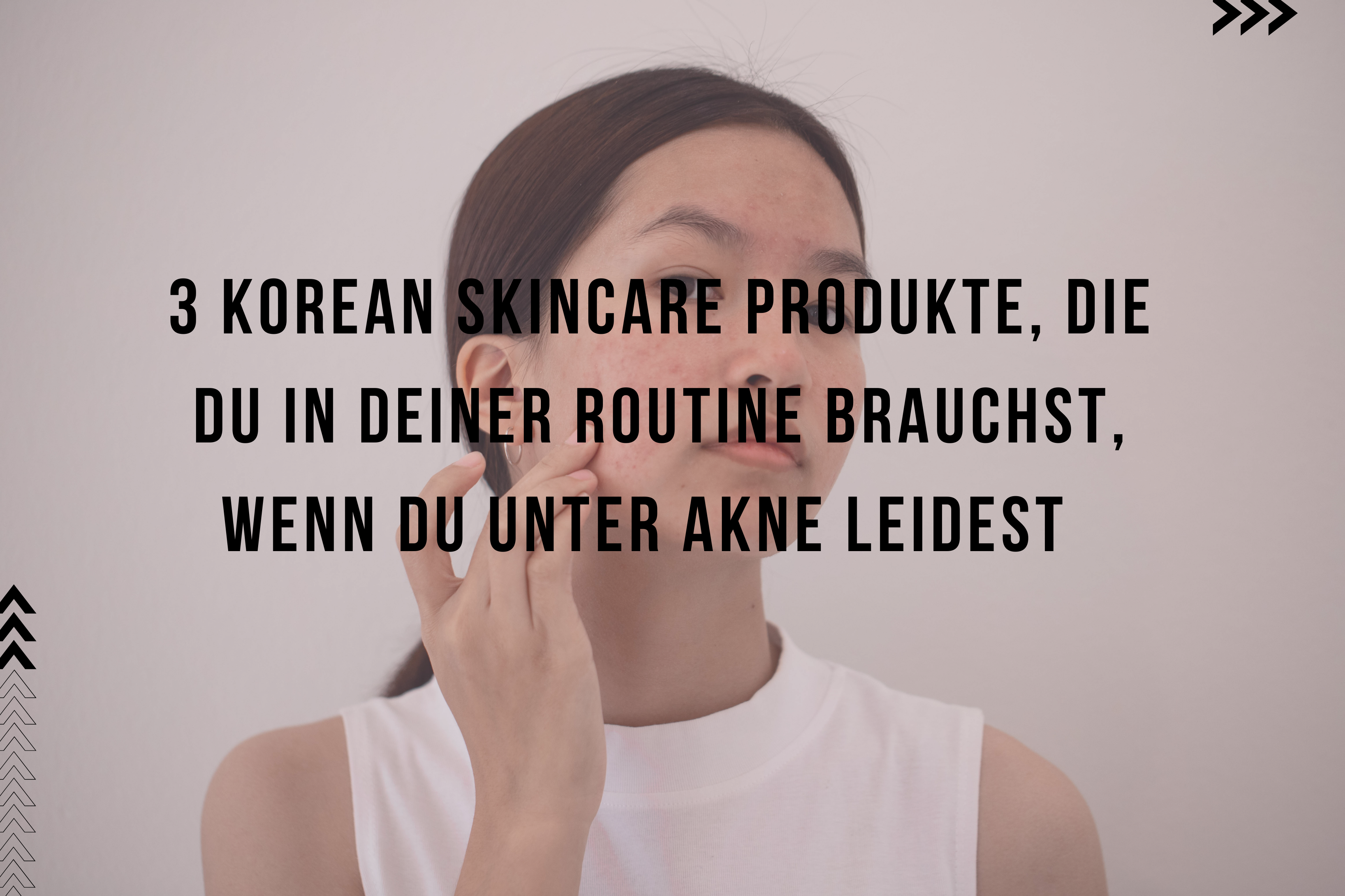3 Korean Skincare Produkte, die du in deiner Routine brauchst, wenn du unter Akne leidest!