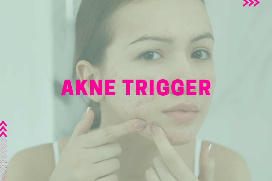 Akne Trigger – Vorsicht, das kann Pickel begünstigen!