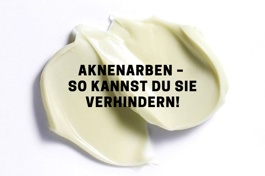 Aknenarben – So kannst du sie verhindern!