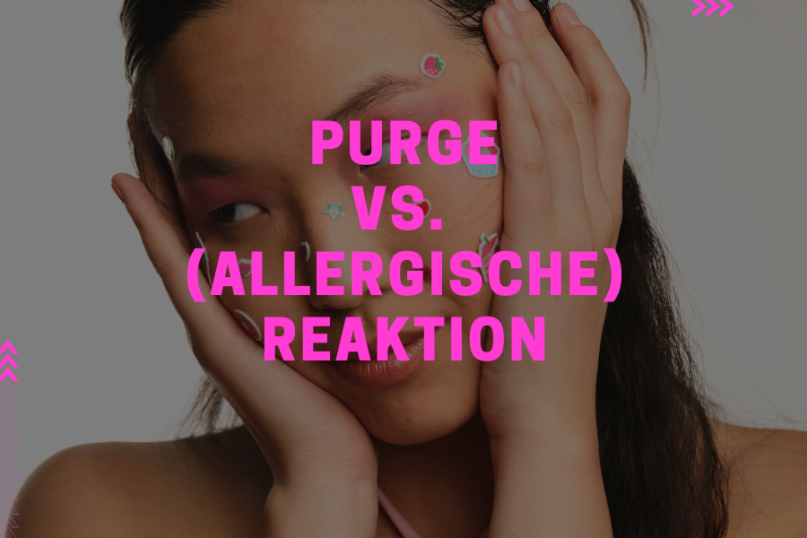 Purge vs (allergische) Reaktion – So merkst du den Unterschied